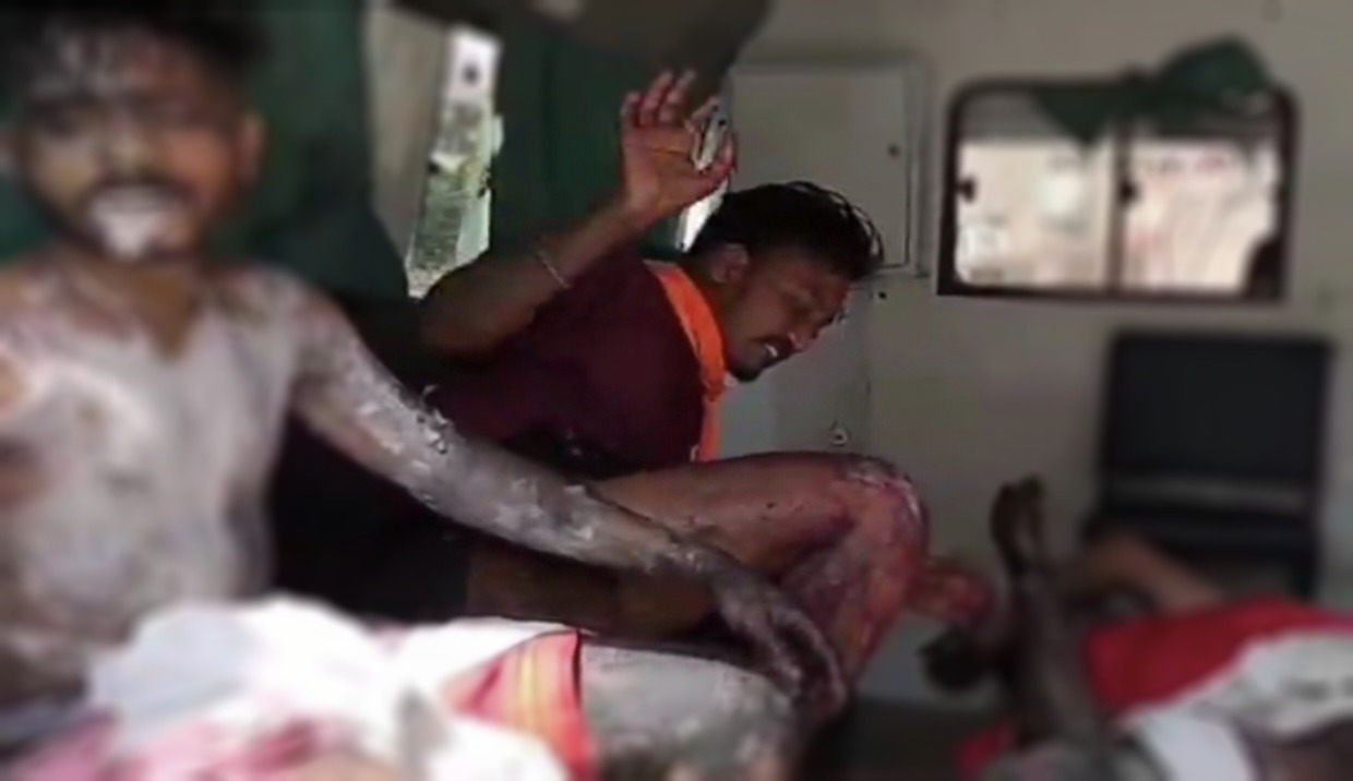 जौनपुर में भीषण सड़क हादसा: तेज रफ्तार स्कॉर्पियो की टक्कर से बाइक सवार तीन युवक एसिड से झुलसे, हालत गंभीर