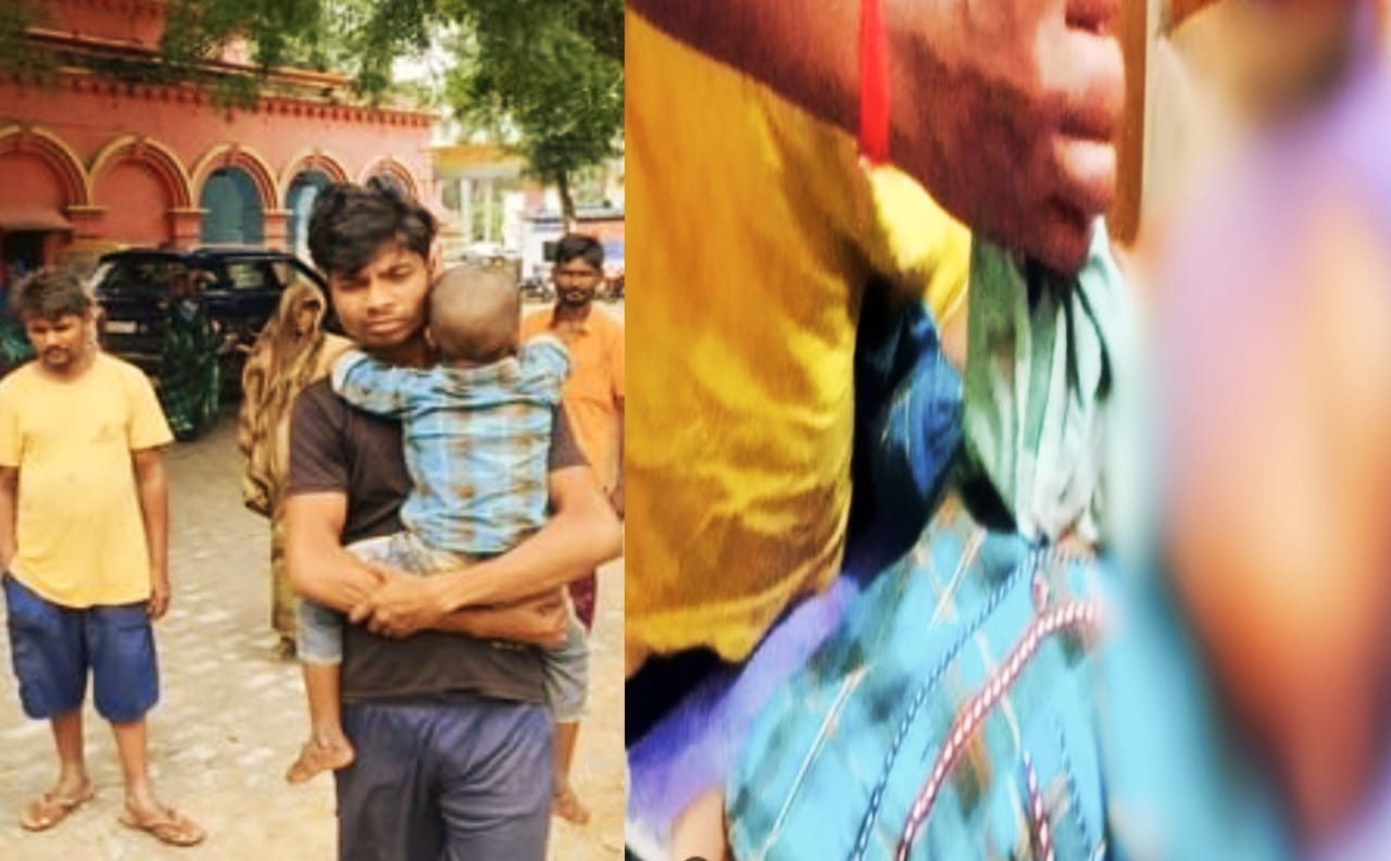 आवारा कुत्ते का हमला, मासूम का नाक नोचकर भागा