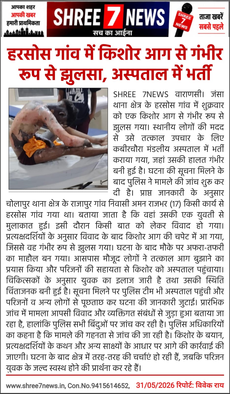 हरसोस गांव में किशोर आग से गंभीर रूप से झुलसा, अस्पताल में भर्ती