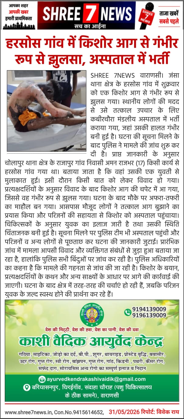 हरसोस गांव में किशोर आग से गंभीर रूप से झुलसा, अस्पताल में भर्ती